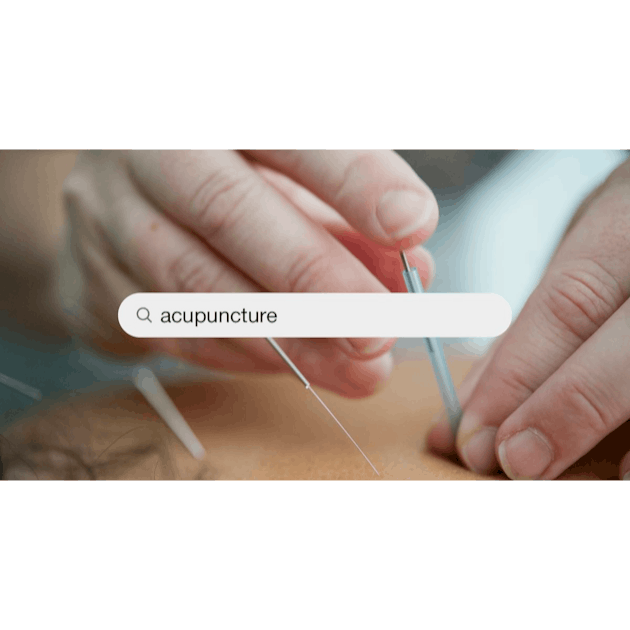 500+ Acupuncture Pictures | Download Free Images on Unsplash