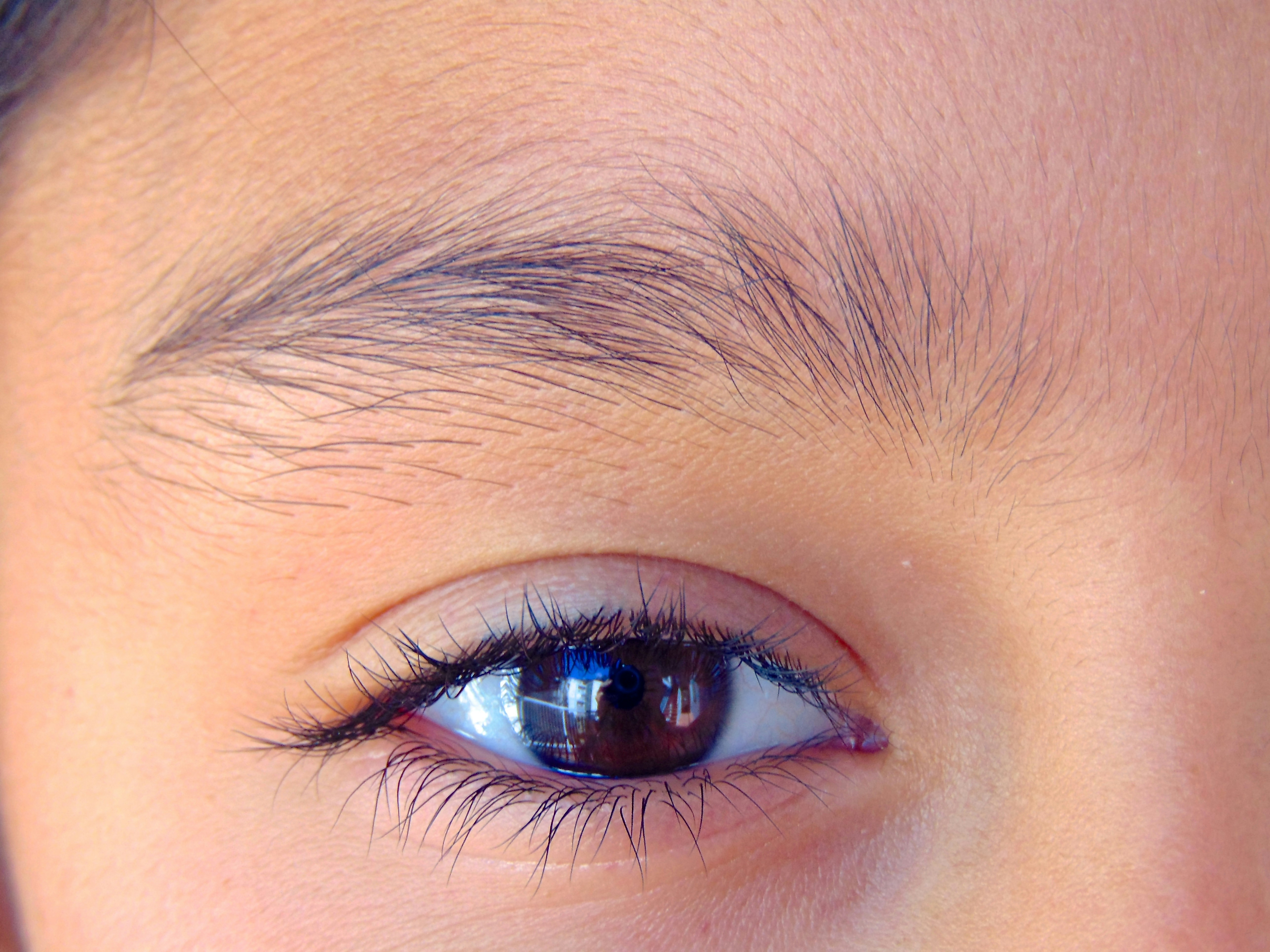 Из-за рыболовного крючка ростовчанин едва не остался без глаза