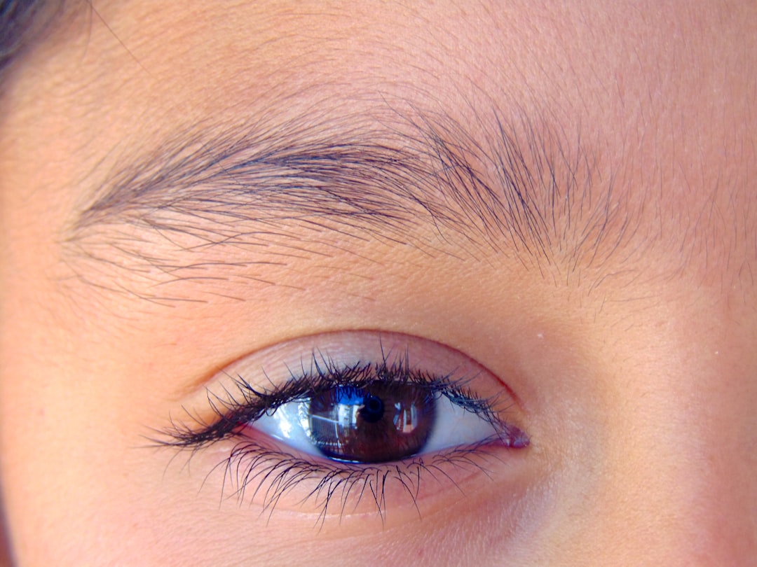 Без ресниц фото Без ресниц фото