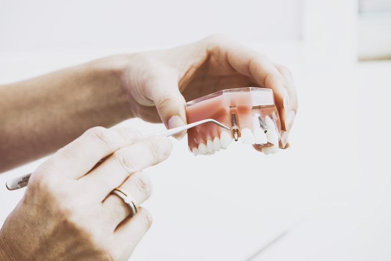 蛀牙了怎麼辦？簡單了解不同程度的蛀牙處理方式