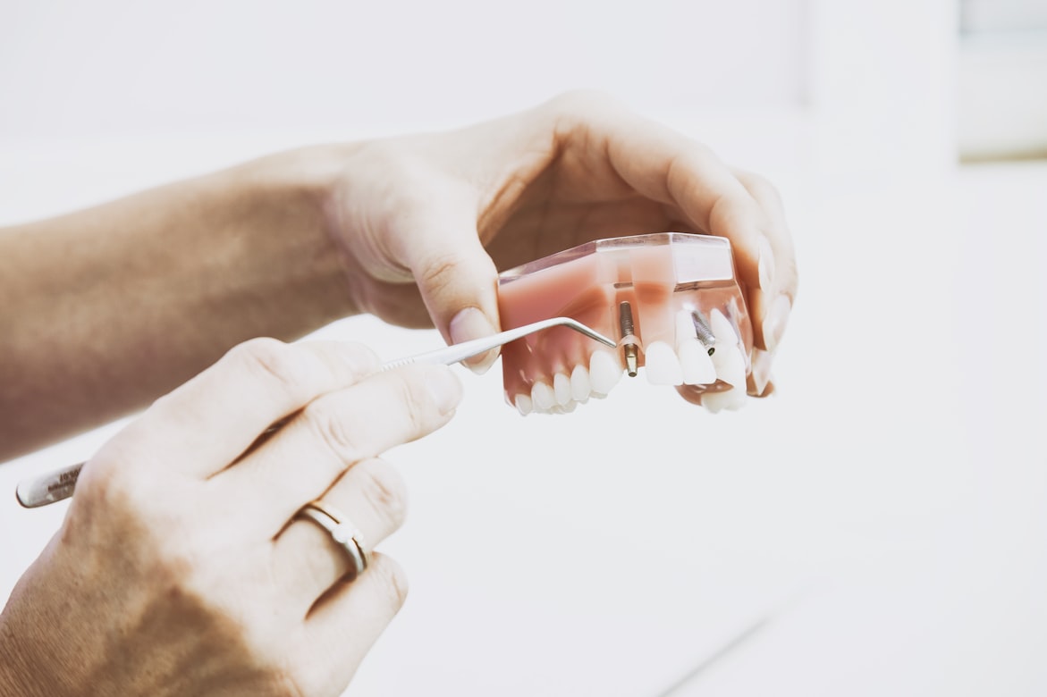 dental implant with insurance