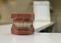 A dental model displaying a set of human teeth with braces. The model is placed on a flat surface, and there is an out-of-focus calendar in the background.