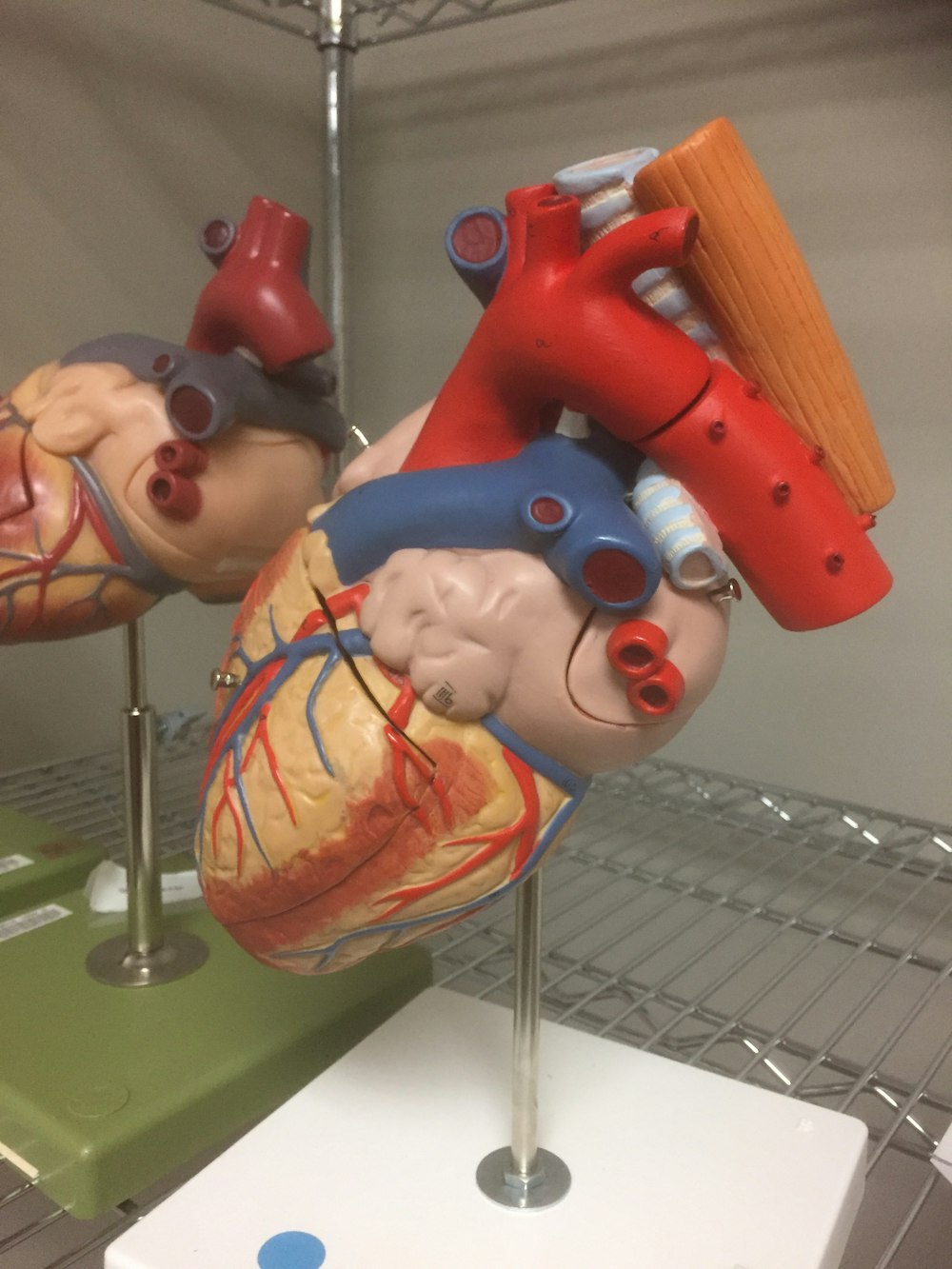Uma exibição de órgão em um consultório médico.