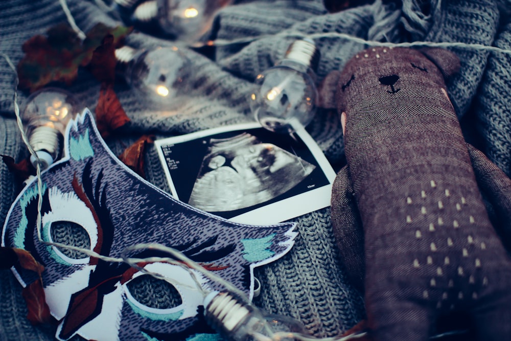 ultrasound photo surrounded by string lights