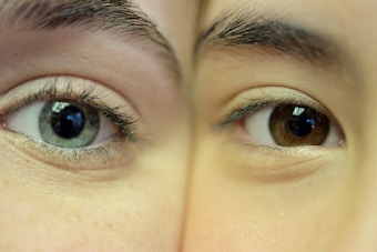 Two human eyes are positioned side by side, highlighting a striking contrast in their colors. The left eye is predominantly blue with a detailed texture, while the right eye is brown. Both eyes feature delicate eyelashes and eyebrows with visible skin tones.