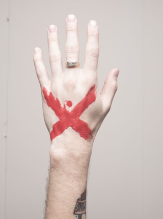 left human hand with x mark