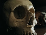 A close-up view of a human skull highlighting key features.