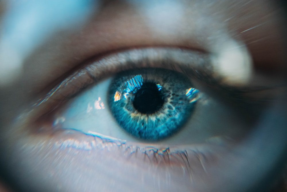 Foto mit dem blauen Auge