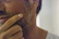Close-up of a confident man touching his smooth jawline after laser session.