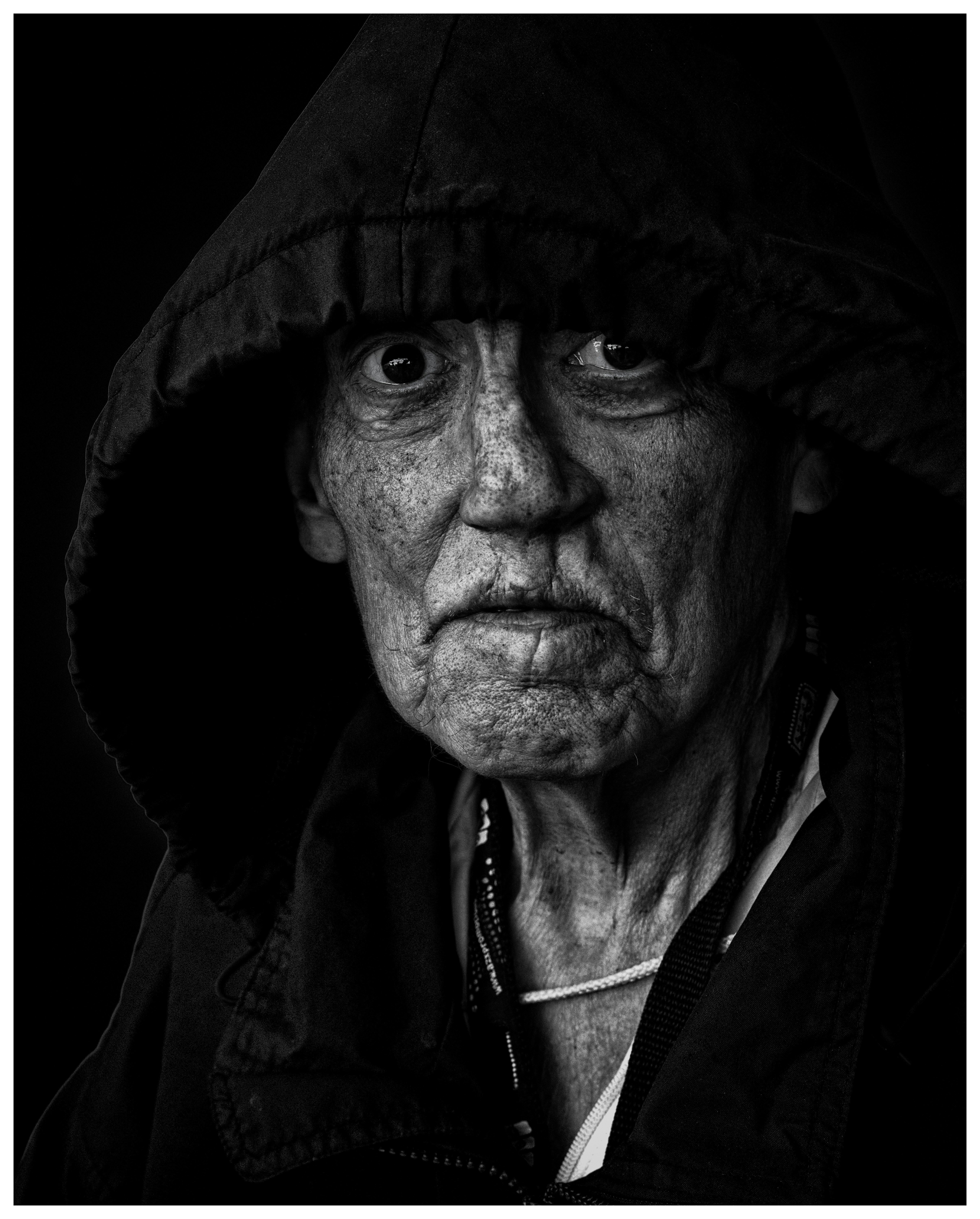 Carol is a semi reluse woman who has undergone numerous surgeries for a cleft palate