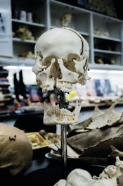 white human skull