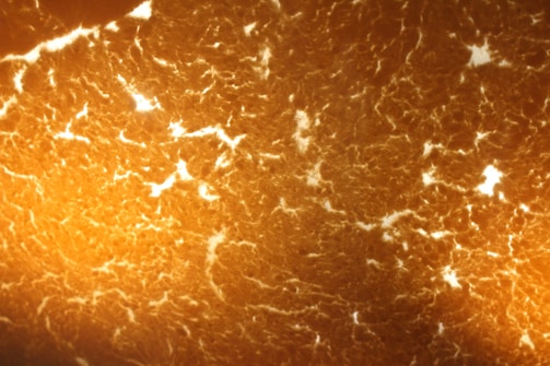 A close-up microscopic view of a textured surface with a marbled pattern. The image displays intricate, organic structures in warm hues, similar to a biological material or surface.