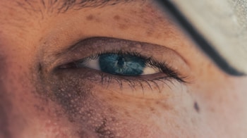 A close-up shot of a human eye with a light blue iris. The surrounding skin shows small freckles and some signs of weather exposure. The focus is sharp on the eye, capturing the intricate details of the eyelashes and the reflective surface of the iris.