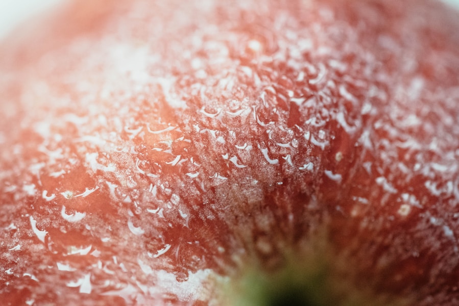Tinea cruris: Simptomi, uzročnici i najbolji tretmani za gljivičnu infekciju prepone i skrotuma