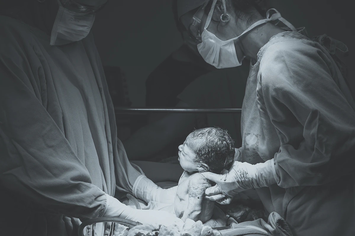Black-and-white photo of medical staff in an operating room during a birth