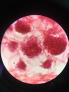 A microscopic view displaying clusters of red-stained particles distributed irregularly across a light background. The particles appear densely packed in certain areas, forming noticeable clumps. The image is contained within a circular field, typical of a microscope slide.
