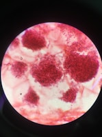 A microscopic view displaying clusters of red-stained particles distributed irregularly across a light background. The particles appear densely packed in certain areas, forming noticeable clumps. The image is contained within a circular field, typical of a microscope slide.