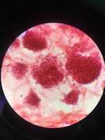 A microscopic view displaying clusters of red-stained particles distributed irregularly across a light background. The particles appear densely packed in certain areas, forming noticeable clumps. The image is contained within a circular field, typical of a microscope slide.
