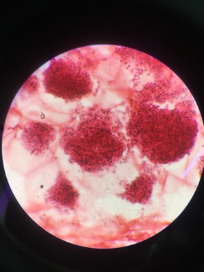 A microscopic view displaying clusters of red-stained particles distributed irregularly across a light background. The particles appear densely packed in certain areas, forming noticeable clumps. The image is contained within a circular field, typical of a microscope slide.