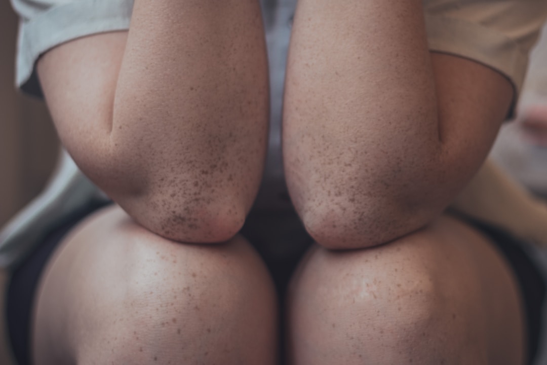 Understanding Arthritis: Managing Knee Pain and Inflammation