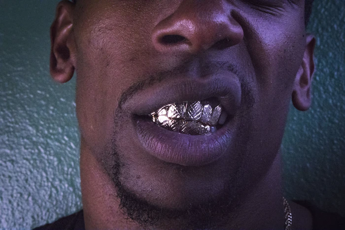 Gold grillz