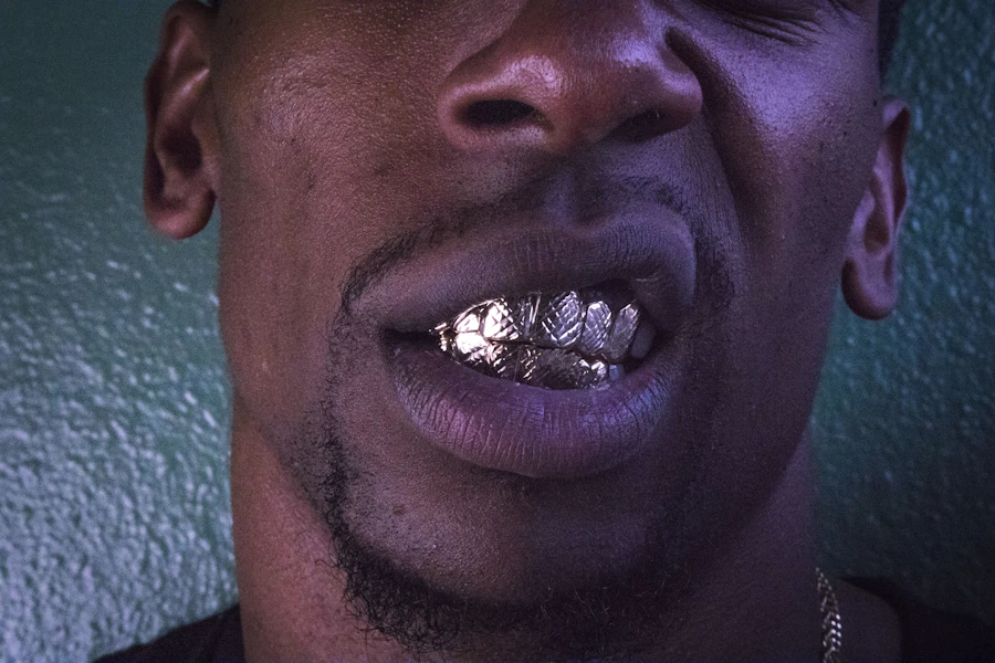 Virgo Jewellers — custom gold grillz