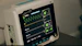 black and white digital heart beat monitor at 97 display