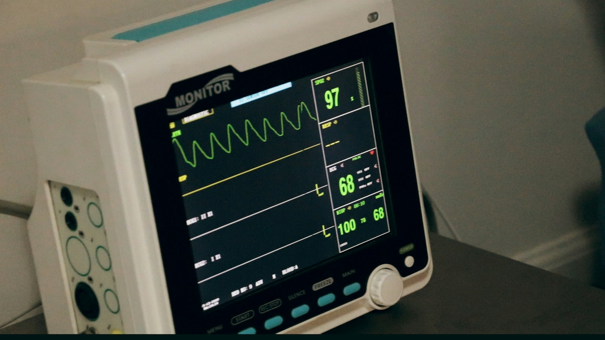 Electrocardiogram