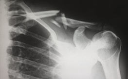 Traumatólogo, dolor articular, artrosis, fracturas
