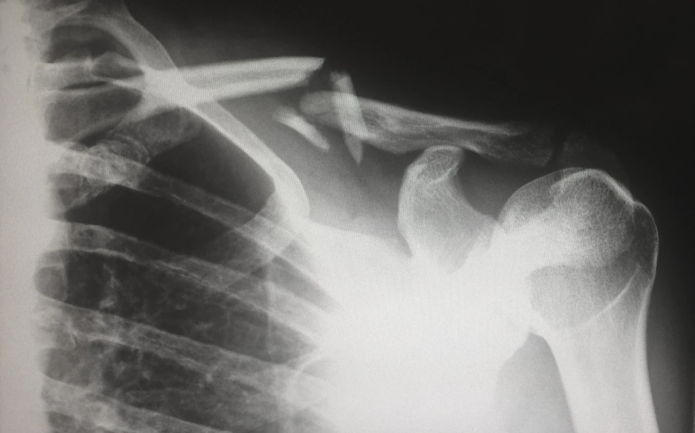 Radiografia digital de tórax e coluna