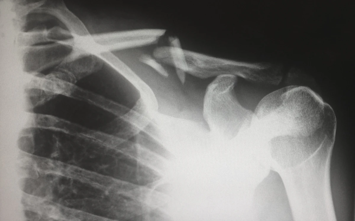 Medical imaging used in neurological assessment, relevant to Bell's palsy evaluation