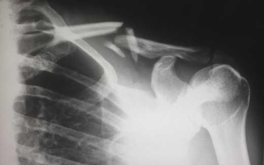 Digital X-ray room with modern equipment