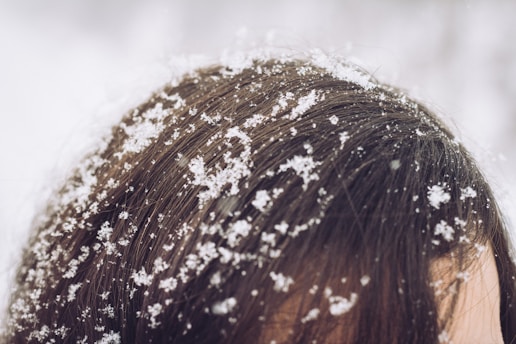 Gentle image of white flakes resting on dark hair strands with a botanical background.