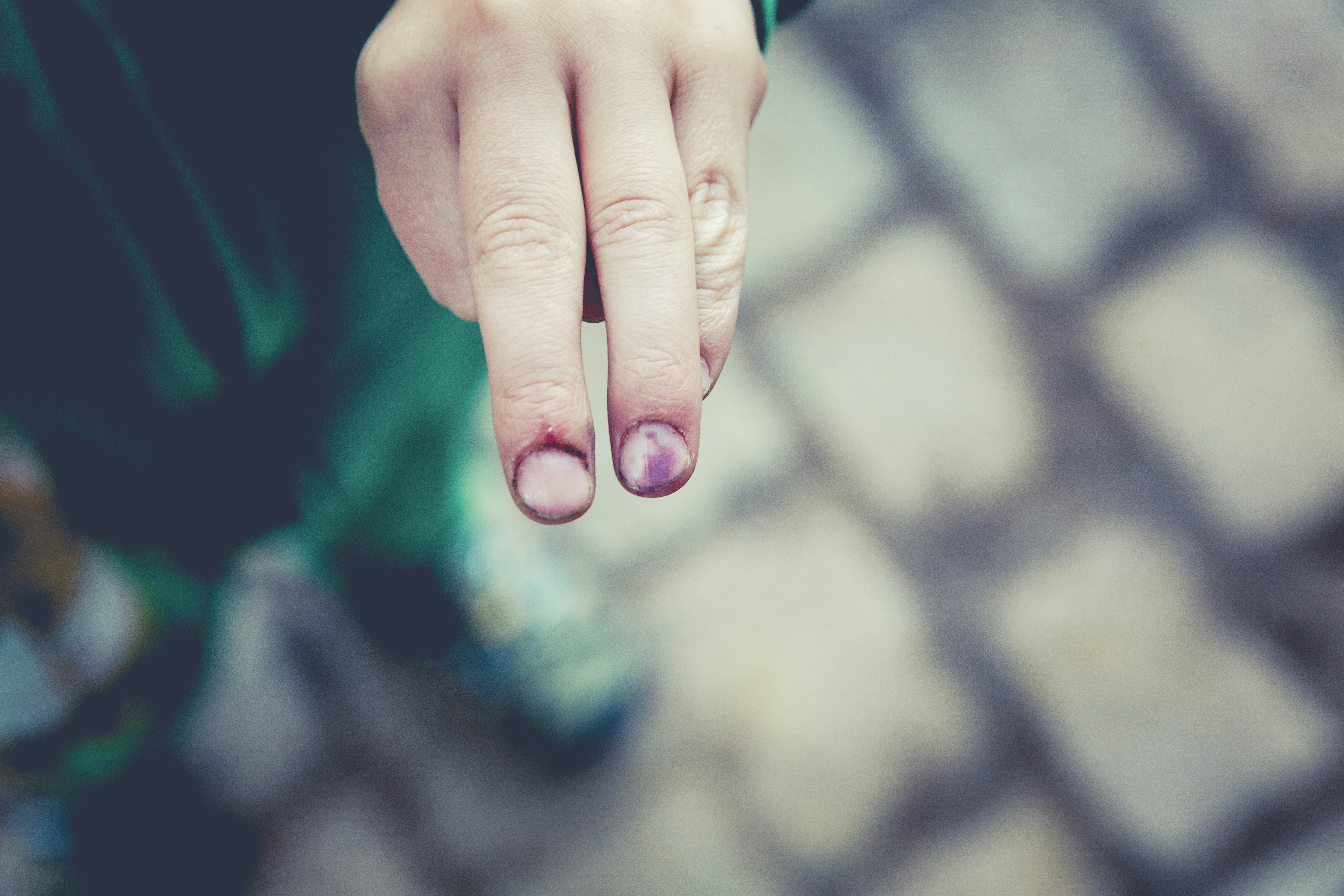 Can You Discuss The Role Of Backboard Padding In Injury Prevention?