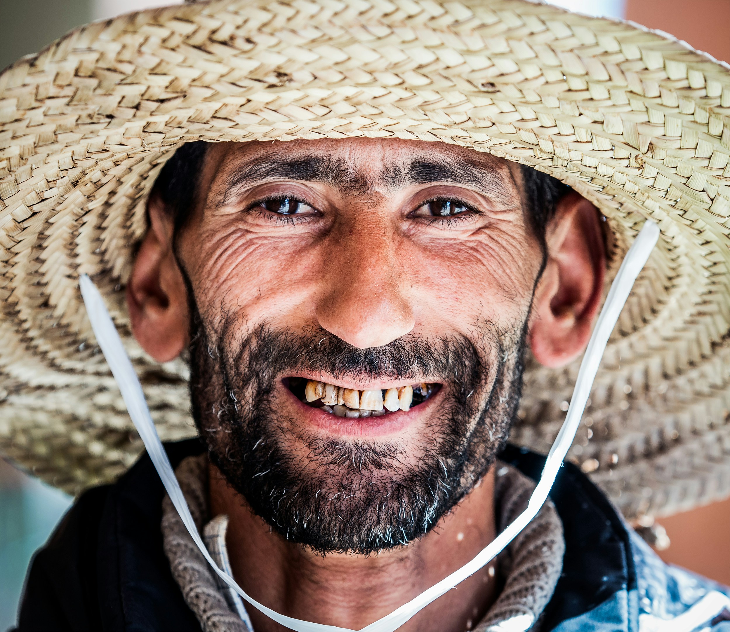 A person smiling with white teeth