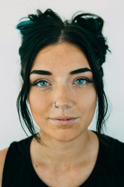 Rosacea: Building a Calmer Routine