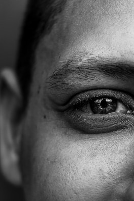 Artistic black and white photo emphasizing natural eye contours post-surgery.