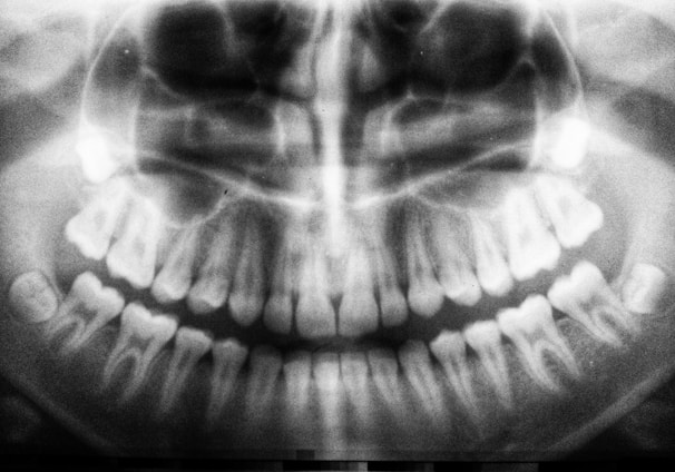 teeth X-ray