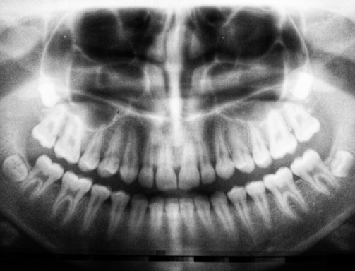 teeth X-ray