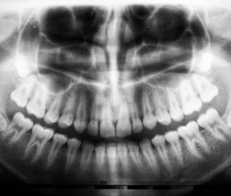 teeth X-ray