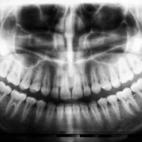 teeth X-ray