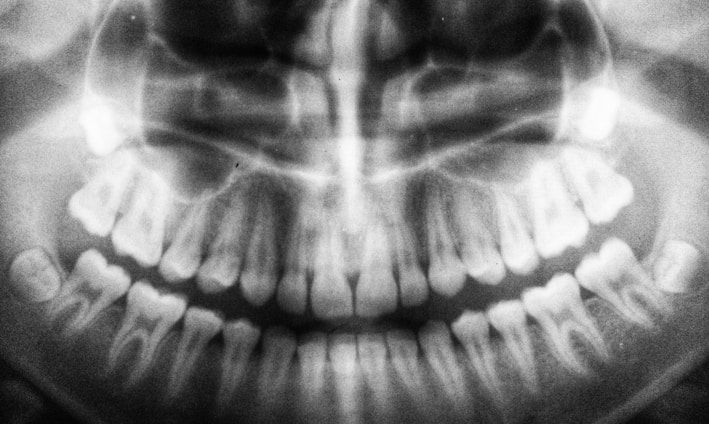 teeth X-ray