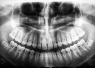 teeth X-ray