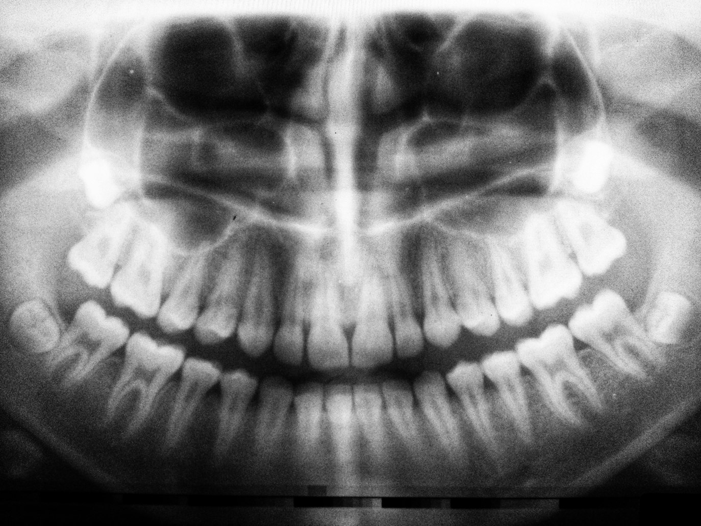 X-ray of person's mouth