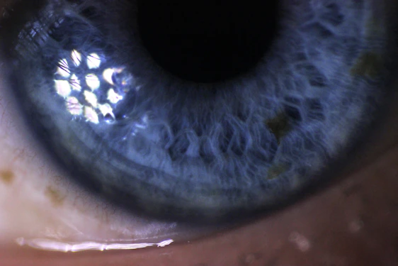 A close-up of an eye showcasing the intricate patterns of the iris.
