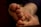 Close-up of a person's foot with short, damaged toenails. The toenails have remnants of dark nail polish, and some appear to have injuries or imperfections. The background is blurred, focusing attention on the foot.