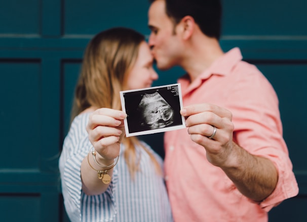 man kissing woman's forehead white holding ultrasound photo