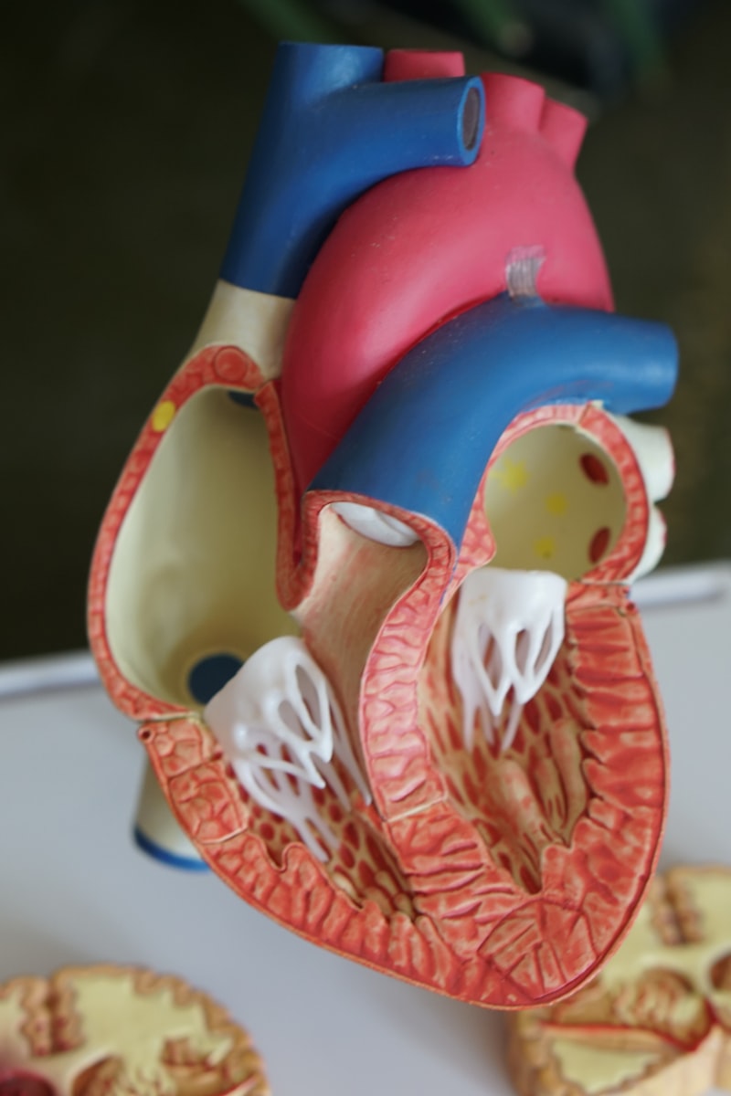 Modello anatomico di cuore in scala, simbolo di aterosclerosi