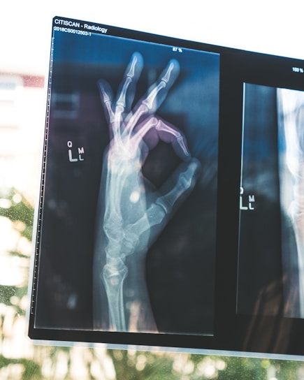 A scan of an X-rayed hand holding up the A-OK hand-sign