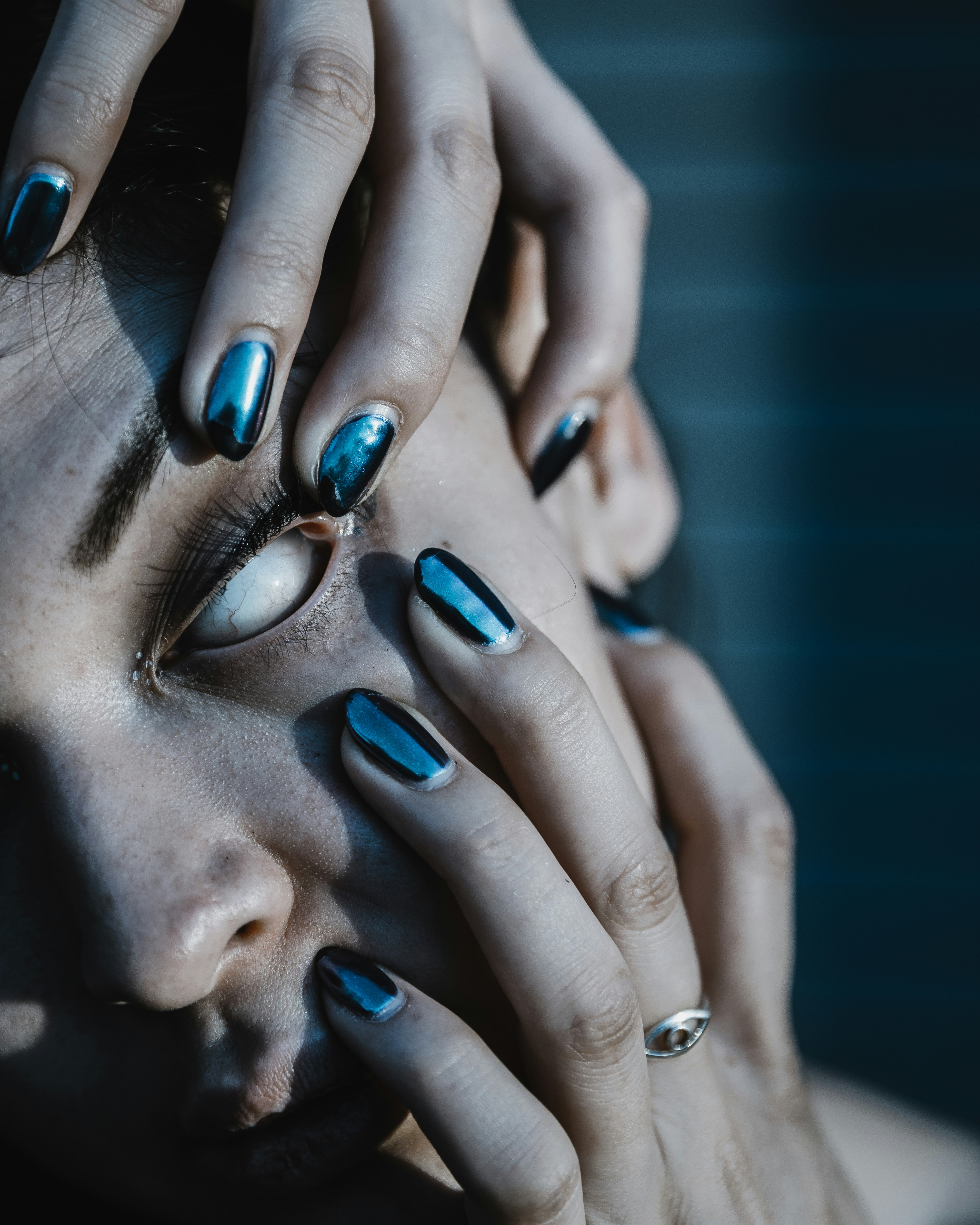 woman forcing open her left eye with both hands, showing an all-white eyeball